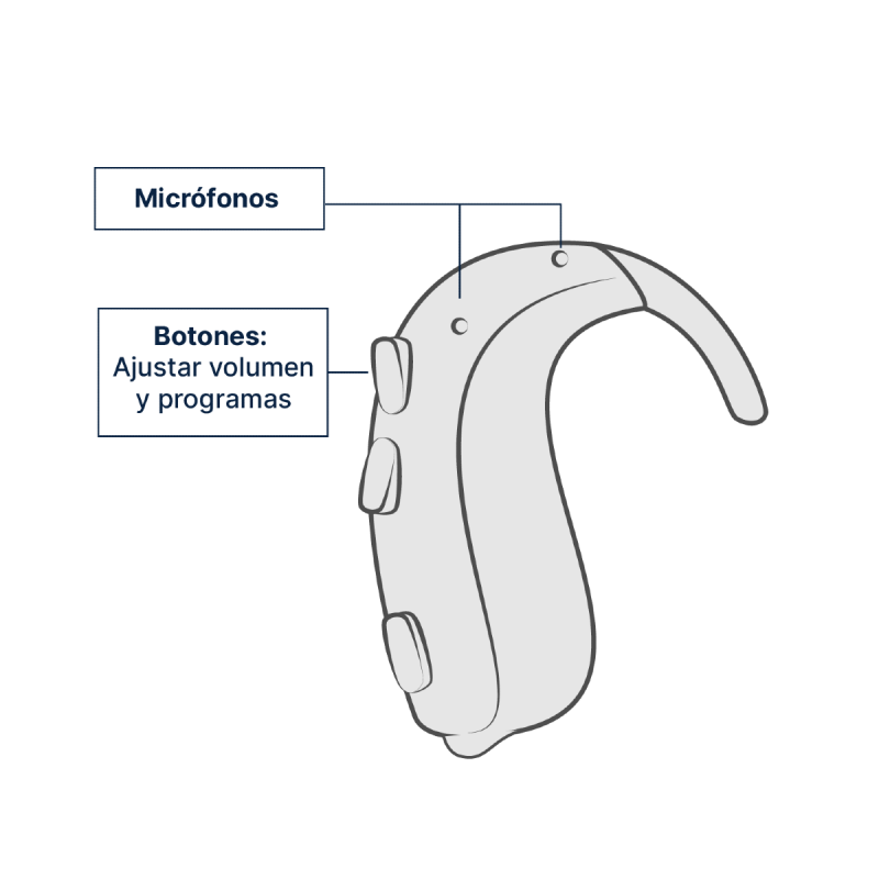 Ilustración de audífono BTE (Detrás de la Oreja) - Vista infográfica de las partes del producto